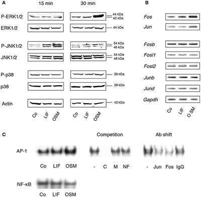 Activation of Shc1 Allows Oncostatin M to Induce RANKL and Osteoclast Formation More Effectively Than Leukemia Inhibitory Factor